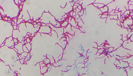 珊瑚色诺卡氏菌的菌株特征与培养条件及相关研究！