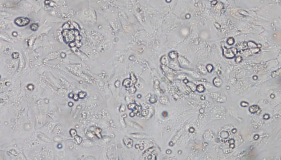 人子宫内膜上皮细胞永生化的使用方法与注意事项！