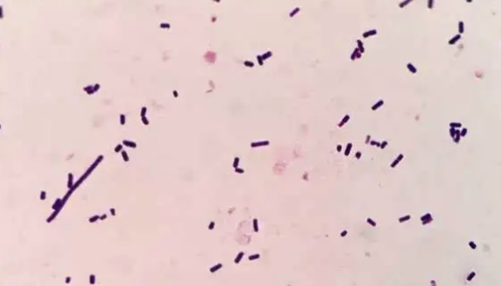 荚膜红细菌的培养条件与注意事项及打管说明！