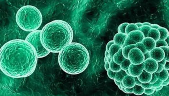 军团菌的病原特点与临床表现及诊断与治疗！