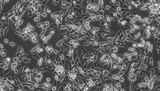 Humanpodocyte人肾足细胞的处理方法与培养步骤！