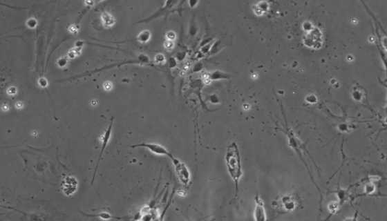 小鼠小脑细胞的制备方法与培养操作步骤！