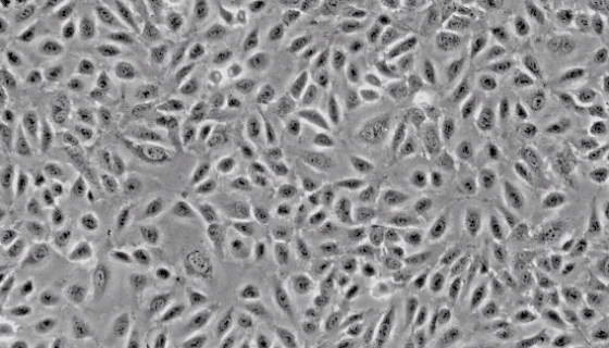 人脐静脉内皮原代细胞+GFP的处理与培养及注意事项！