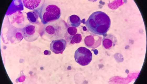 大鼠腹水癌细胞系的处理方法与实验操作步骤！