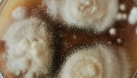 红色毛癣菌的生长速度与镜下形态及鉴别依据！