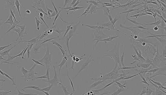 人胚肺成纤维细胞HELF的培养步骤与注意事项！