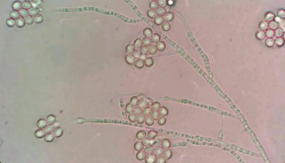 ATCC 700198 福赛坦氏菌的特点与优势及培养！