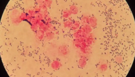 用于生产芳烃类固醇的：红平红球菌