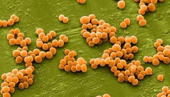 金黄色葡萄球菌的危害及感染的预防方法！