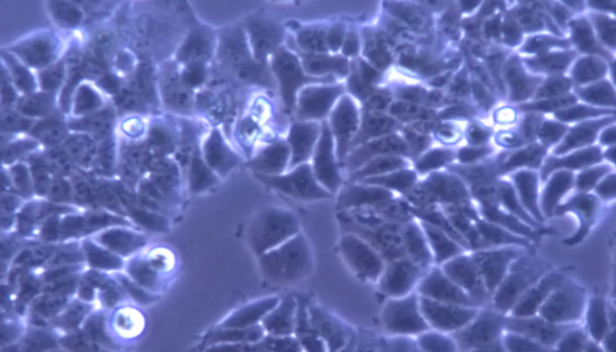 人风湿性关节滑膜成纤维细胞永生化的操作步骤！