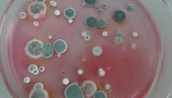 霉菌酵母菌检测过程中常见问题及解答！