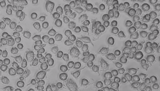 小鼠胚胎干细胞R1收到后的处理方法与培养步骤！