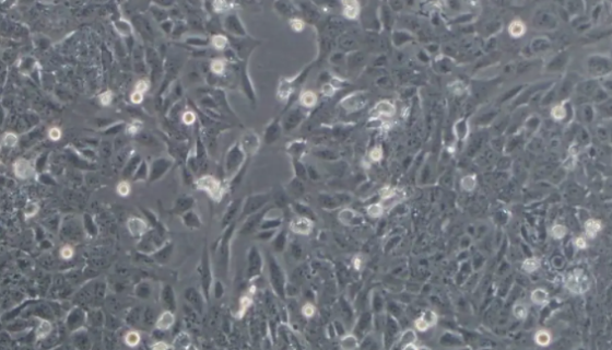 C-9 人肺癌细胞接收后的处理方法与培养步骤！