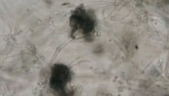 嗜松青霉的生物特性与培养条件及注意事项！