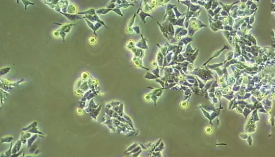 小鼠肺癌细胞带绿色荧光的培养方法及到货须知！