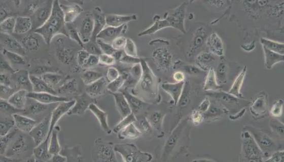 人非小细胞肺癌细胞的处理方法与培养步骤！