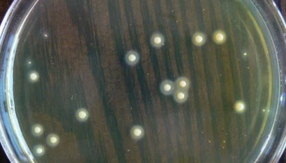 白色葡萄球菌的培养与灭菌方法及主要用途！