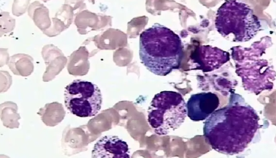 NPC/HK-1人鼻咽癌细胞的培养方法与注意事项！