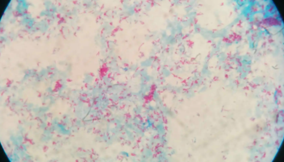 ATCC 19423 溃疡分枝杆菌 百欧博伟生物