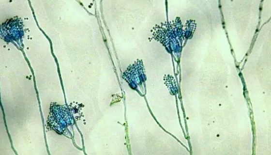 吸水链霉菌吸水亚种的培养方法与实验内容！