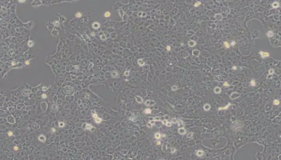 SCC-15人舌磷癌细胞的培养与使用操作步骤！
