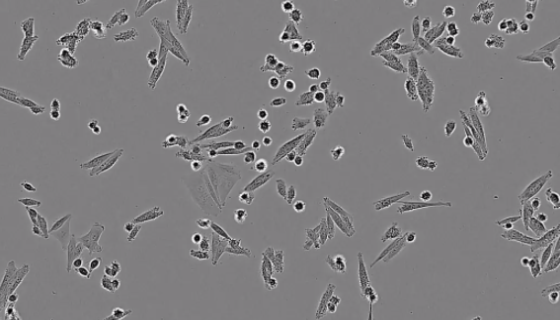 实验室分离人表皮黑色素细胞的方法及操作步骤！