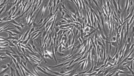 人乳腺成纤维细胞的运输和保存及使用方法！