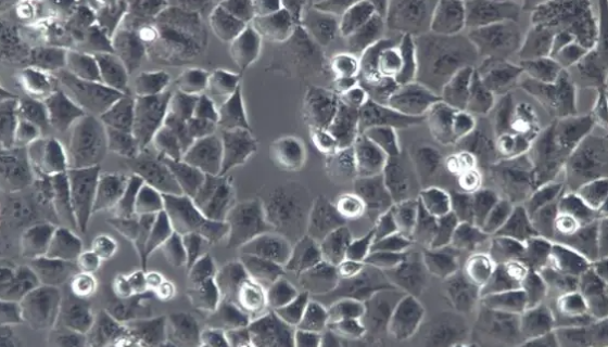 小鼠软骨肉瘤细胞收到后的处理方法与培养步骤！