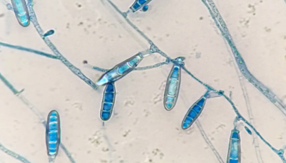 可可毛色二孢菌——药用植物内生菌