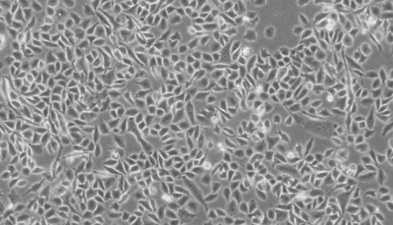 RKO人结肠腺癌细胞的培养步骤与应用！