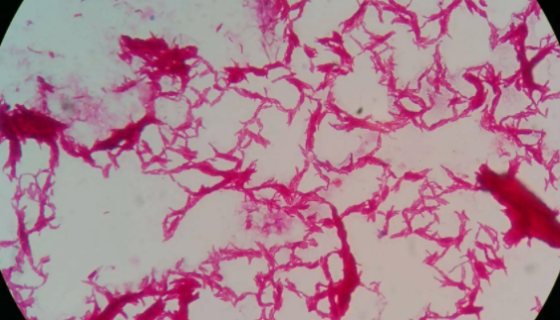 结核分歧杆菌的生物学性状与培养特性及生化反应！