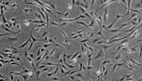 MPASMC(小鼠肺动脉平滑肌细胞)的处理方法与培养步骤！