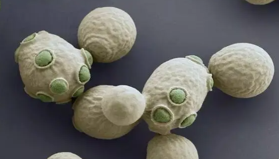 椭圆酿酒酵母的形态特征与培养方法及注意事项！