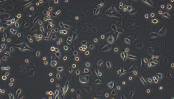 永生化人视网膜周细胞的处理方法与培养步骤！