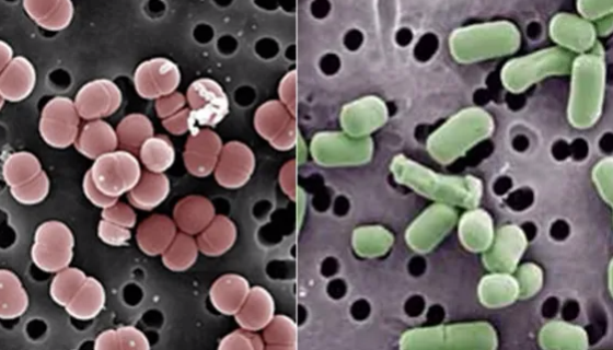 阴道阿波托菌的培养方法与使用范围及注意事项！