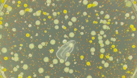 恶臭假单胞菌的临床意义与表现及微生物学检验！