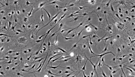 小鼠角质形成细胞接受后的处理方法与培养步骤！