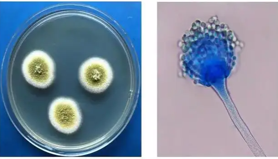 黄色篮状菌的形态特征及培养与保藏方法！