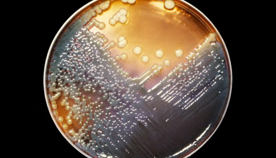 产气肠杆菌的分离和鉴定及用途和检测！