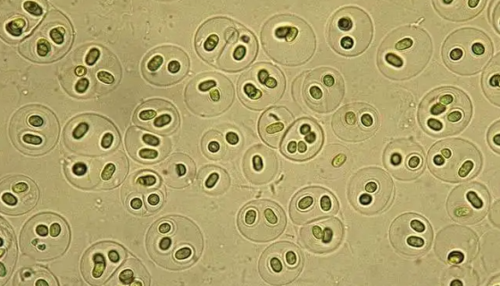 水生黄杆菌的形态特征与培养方法及打管说明！