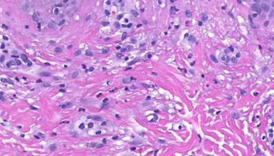 人角质形成细胞的使用与组成及主要作用！