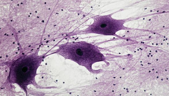 小鼠神经细胞收到后的处理与使用方法及培养步骤！