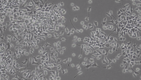鸡巨噬细胞的生长条件与培养操作流程及注意事项！