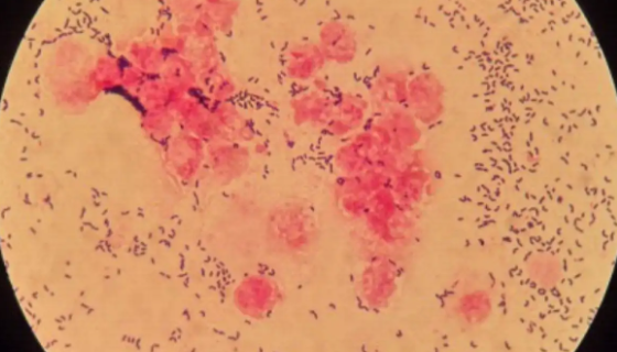 ACCC 10543 红平红球菌的形态特征与菌株优势！