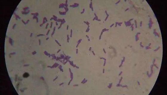 积磷小月菌的特点与优势及培养操作步骤！