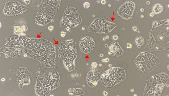 CACO-2细胞专用培养基的生长特性及应用！
