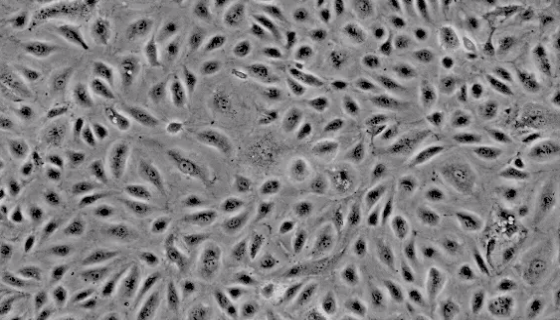 人血管内皮细胞的生理功能及相关研究！