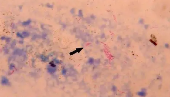 ATCC 43015 鸟分枝杆菌副结核亚种知识解析！