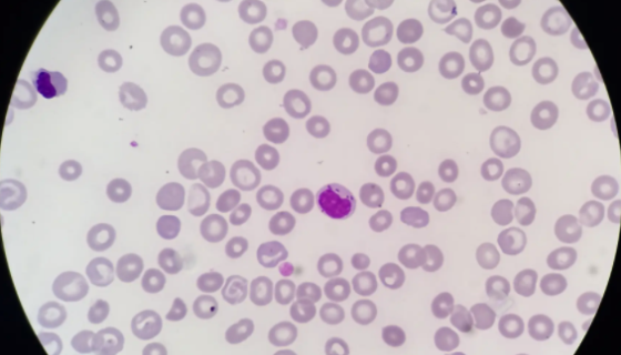 人骨髓增生异常综合征细胞株的处理方法与培养步骤！