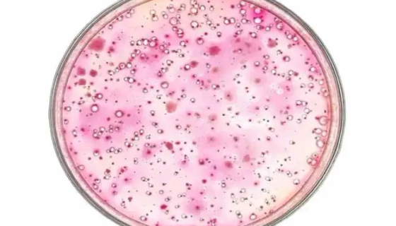 MUG培养基的背景与应用！百欧博伟生物